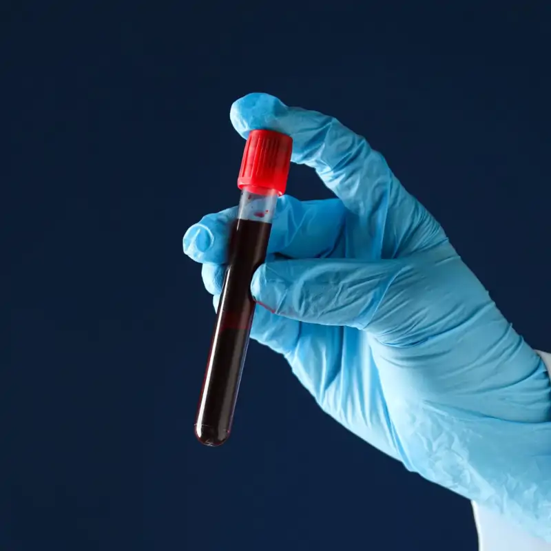 Un simple análisis de sangre podría detectar el regreso del cáncer meses antes que una exploración