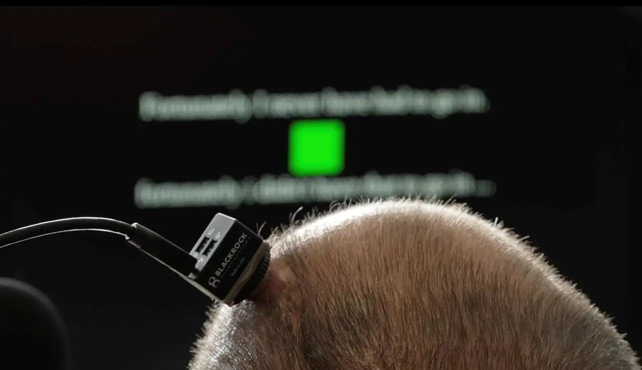 neuroimplante