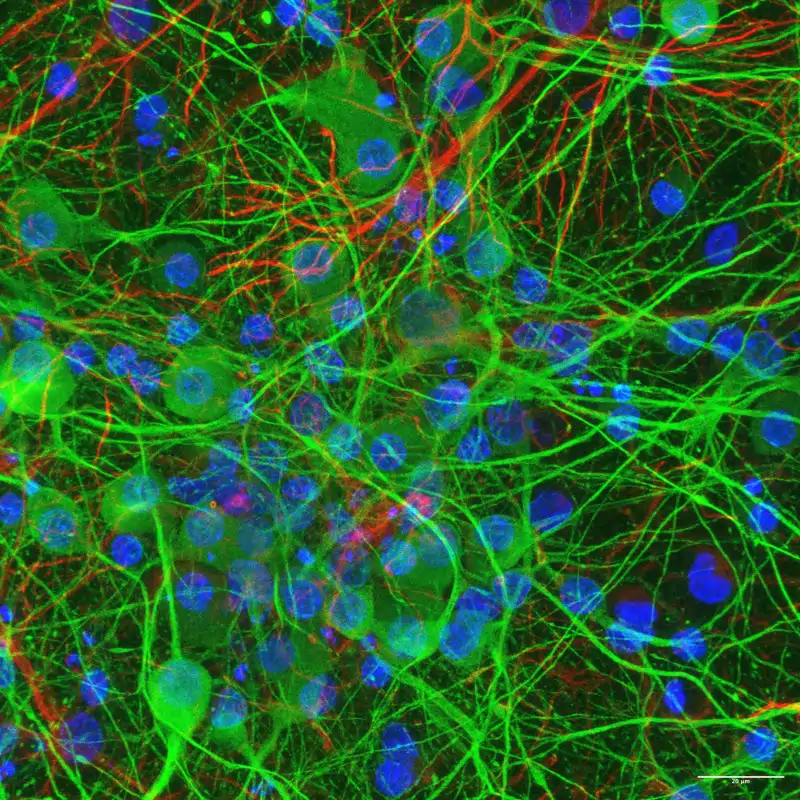 Cultivo 2D de c&#233;lulas neuronales corticales (de cerebro): neuronas (verde) y c&#233;lulas de gl&#237;a (rojo). Los n&#250;cleos de las c&#233;lulas est&#225;n tintados de azul. 
