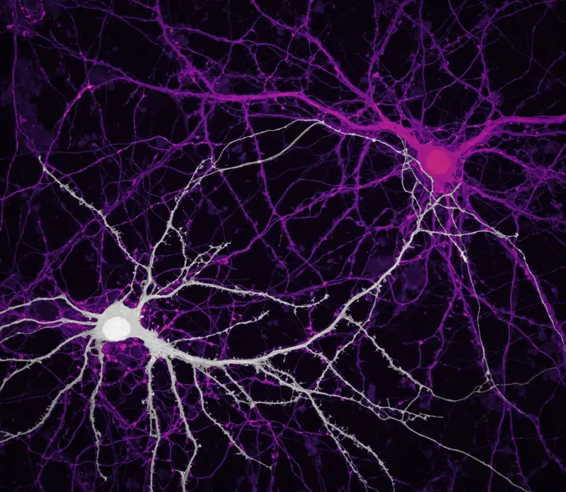 Conexiones entre neuronas del hipocampo