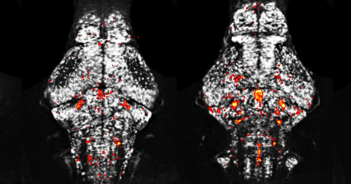 Zebrafish Sleep Research Reveals Genetic Links to Animal Sleep Patterns and Neurodevelopmental Disorders