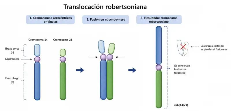 Traslocación robertsoniana