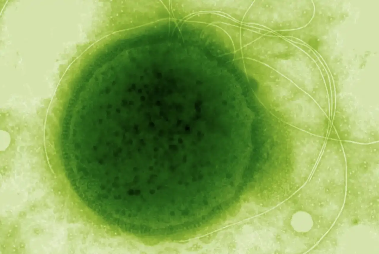 Microfotografía de la arquea 'Thermococcus gammatolerans'